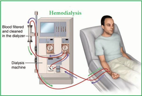 Haemodialysis of chronic kidney disease patients - ECHS